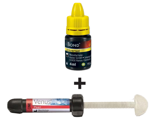 kulzer-ibond+venus+one kulzer-ibond+venus+one